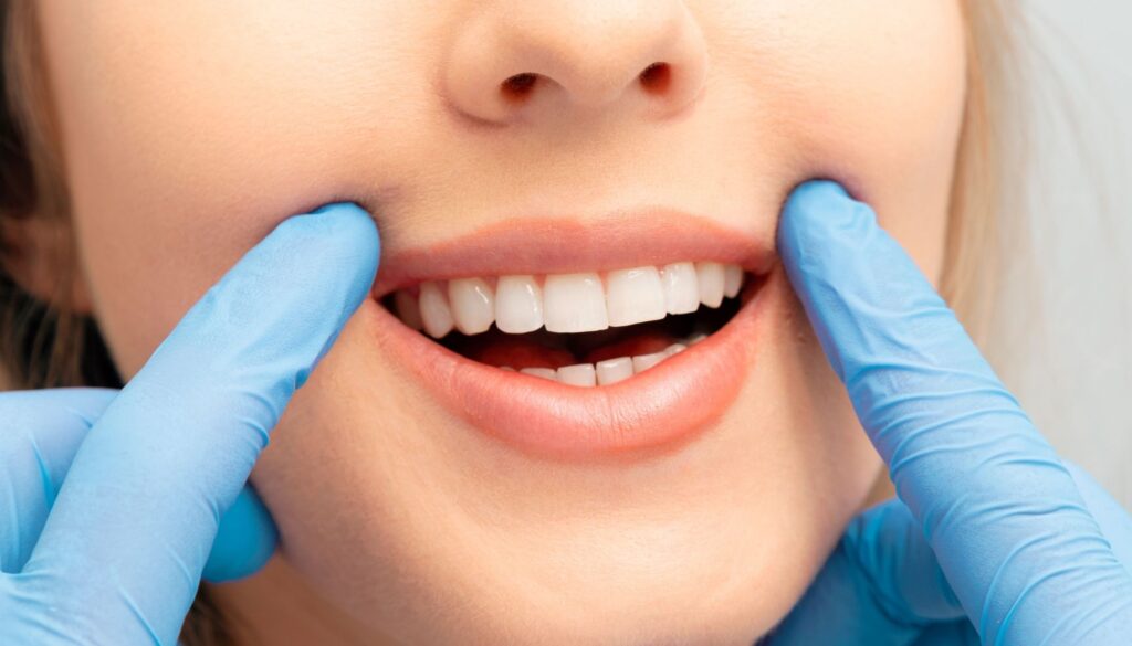 Clareamento Dental Chaude Odonto Águas Claras DF